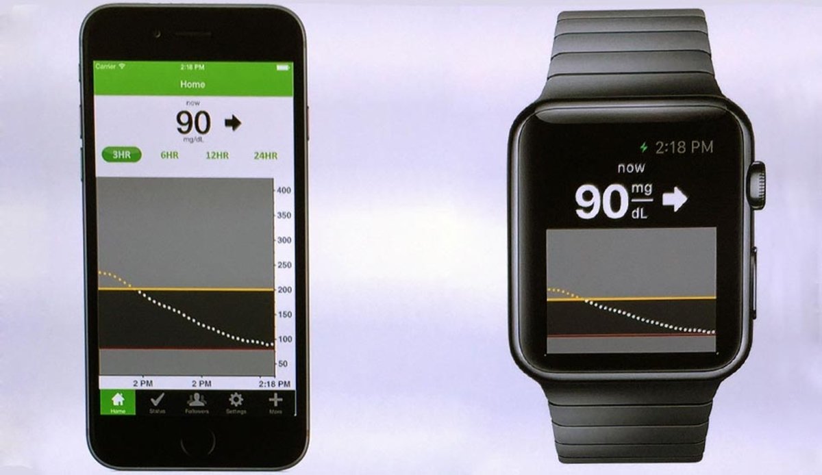 El próximo Apple Watch tendría medidor de glucosa en sangre, sin