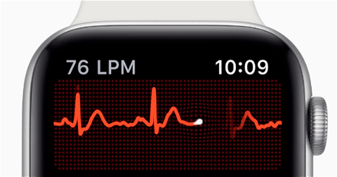 Nuevo Apple Watch SE: ¿un Series 5 sin ECG?
