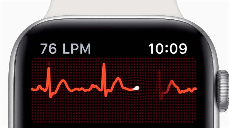 Su Apple Watch detectó una enfermedad de corazón que en el hospital pasaron por alto