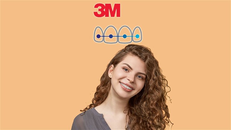 3M Clarity Smile, una app para simular cómo te quedarían los brackets