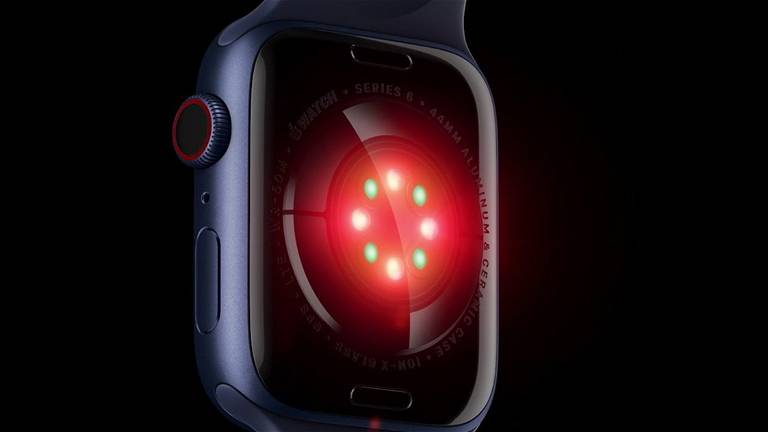 Apple pone a uno de sus trabajadores más importantes a cargo del sensor de glucosa en sangre del Apple Watch