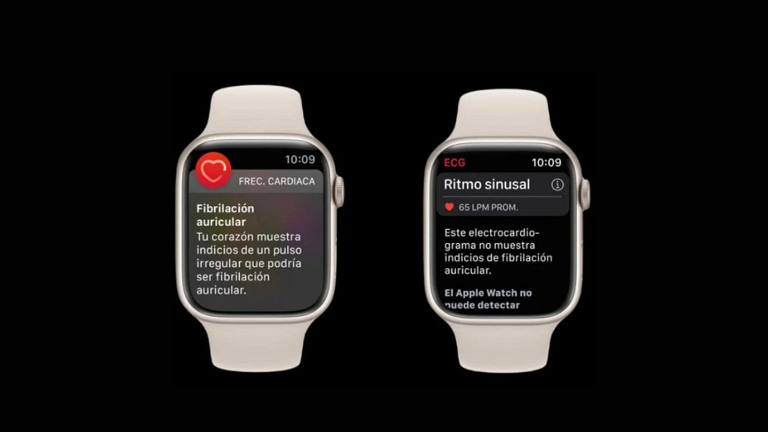 El Apple Watch detecta un problema cardíaco oculto que ha podido salvar la vida a su dueño
