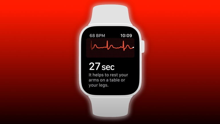 What does atrial fibrillation mean on Apple Watch?