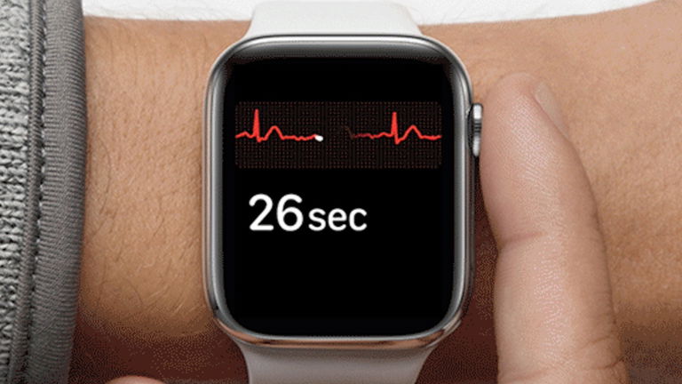 Cómo hacer un electrocardiograma en el Apple Watch